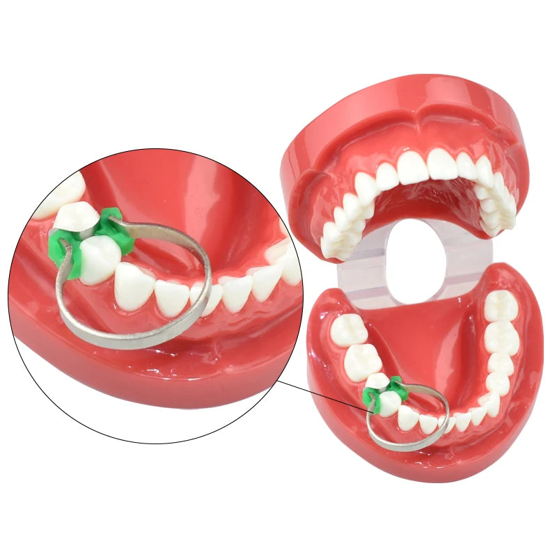 100Pcs/box Dental Sectional Contoured Matrices Matrix Ring Delta Wedges