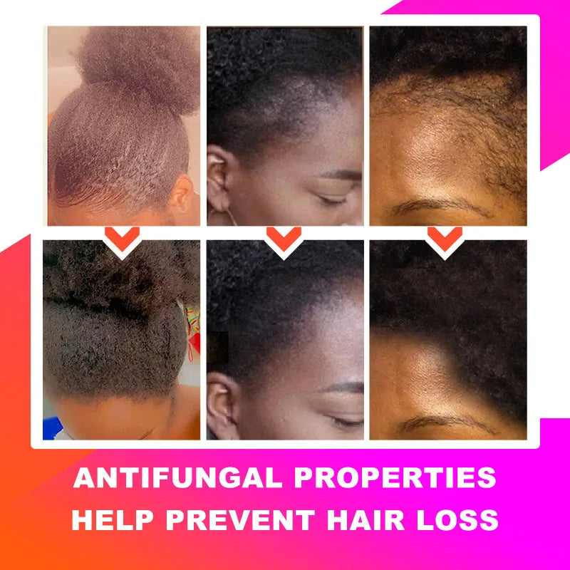 Fast Hair Growth Set Chebe Oil Traction Alopecia Hair Mask Anti Break Loss Hair Growth Oil Baldness Treatment Hair Care Products
